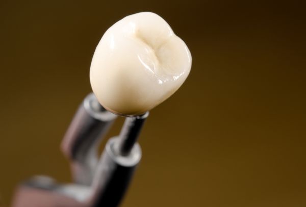 Do Dental Crowns Look Natural?
